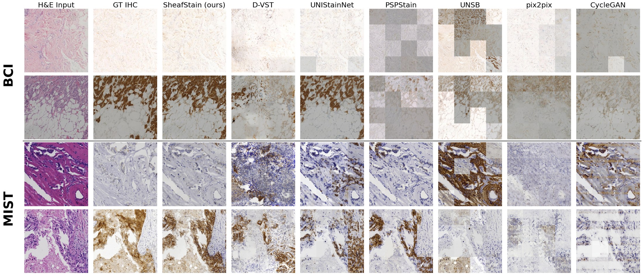 Qualitative comparison on BCI and MIST HER2: input H&E, outputs of prior methods and SheafStain, and the ground-truth IHC.